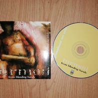 CD Turmoil From bleeding Hands
