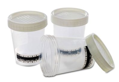 5 x Steriler Urinbecher/ Probenbecher Schraubverschluss 120 ml mit Temperaturanzeige