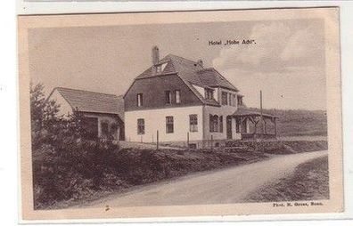 60569 Ak Hotel "Hohe Acht" bei Adenau in der Eifel um 1900
