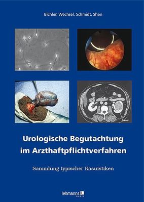 Urologische Begutachtung im Arzthaftpflichtverfahren: Sammlung typischer Ka ...