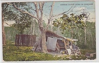 61766 Ak China Chinese Leper living in Cemetery 1901