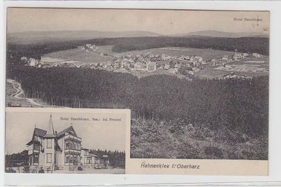 70903 Mehrbild Ak Hahnenklee im Oberharz Hotel Tannhäuser um 1910