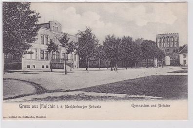 91148 Ak Gruß aus Malchin Gymnasium und Steintor um 1910
