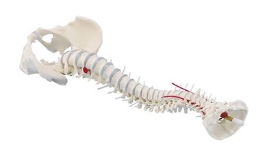 anatomisches Modell, Wirbelsäule mit Bandscheibenvorfall und Becken, ohne Stativ