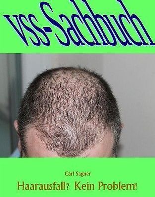 Ebook - Haarausfall? Kein Problem von Carl Sagner