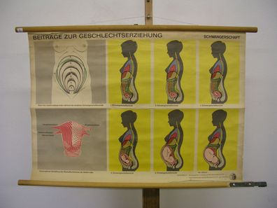 schönes Schulwandbild Schwangerschaft der Frau 83x58 vintage school map 1960