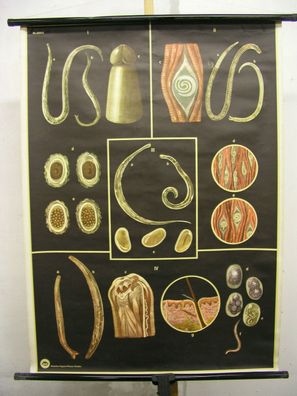 Schulwandbild Wandbild Bild Darm Darmparasiten Parasiten Bandwurm Würmer 81x110