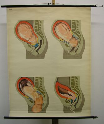 schöne Schulwandkarte Geburtsvorgang Mutter Kind 83x109cm Bild vintage map 1960