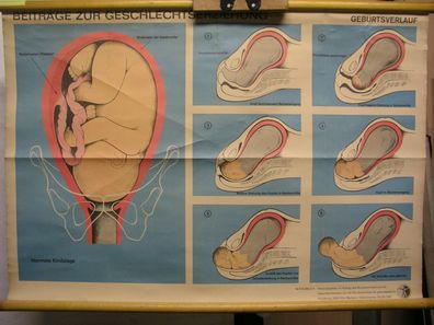 Wandbild Geschlechtserziehung Geburtsverlauf 83x56 1965 vintage childbirth chart
