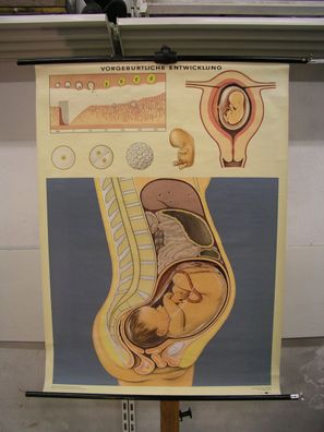Schwangerschaft Baby Entwicklung bis Geburt 1962 Schulwandbild Wandbild 83x113cm