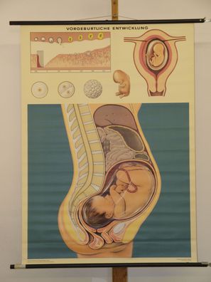Schwangerschaft Baby Entwicklung bis Geburt 1969 Schulwandbild Wandbild 83x113cm