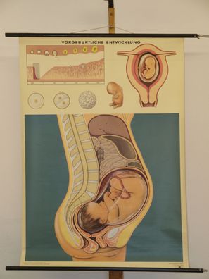 Schwangerschaft Baby Entwicklung bis Geburt 1962 Schulwandbild Wandbild 82x113cm