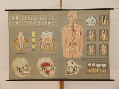 Gebiss Zähne Zahnarzt Kieferchirurg Lehrtafel Schaubild 1965 Wandbild 164x114cm