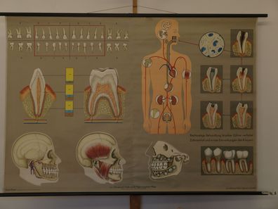 Gebiss Zähne Zahnarzt Kieferchirurg Lehrtafel Schaubild 1965 Wandbild 166x115cm