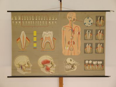 Gebiss Zähne Zahnarzt Kieferchirurg Lehrtafel Schaubild 1965 Wandbild 166x123cm