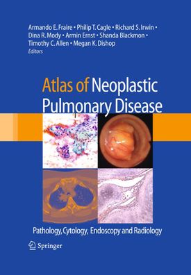 Atlas of Neoplastic Pulmonary Disease: Pathology, Cytology, Endoscopy and R ...
