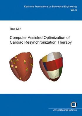 Computer assisted optimization of cardiac resynchronization therapy