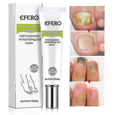 Efero Nagelpflegecreme gegen Verbrennungen, Nagelpflege, 20 g