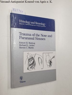 Mathog, Robert H., Richard L. Arden and Steven C. Marks: Trauma of the Nose and Paran