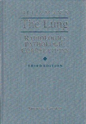 Groskin, Stuart A.: Heitzman's The Lung Radiologic-Pathologic Correlations :