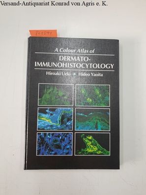 Ueki, Hiroaki and Hideo Yaoita: Color Atlas of Dermatoimmuno Histocytology (Wolfe Med