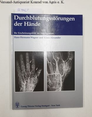 Wagner, Hans-Hermann und Klaus Alexander: Durchblutungsstörungen der Hände