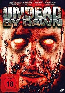 Undead By Dawn (DVD] Neuware