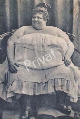 Foto Postkarte Johanna schwerstes Mädchen der Welt Bayern H1.72