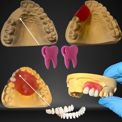 Dental Base, Prothesen Reparatur, Dental pink gum Material