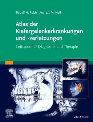 Atlas der Kiefergelenkerkrankungen und -verletzungen, Andreas Neff