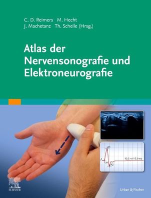 Atlas der Nervensonografie und Elektroneurografie, Martin Hecht