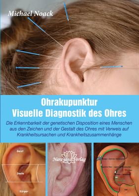 Visuelle Ohrdiagnostik als Grundlage der Ohrakupunktur - Krankheitsursachen ...