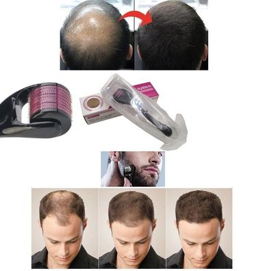Derma Roller 540 Nadeln Roller für Haarwachstum Hautpflege Körper Behandlung