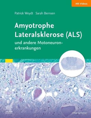 Amyotrophe Lateralsklerose (ALS) und andere Motoneuronerkrankungen, Patrick