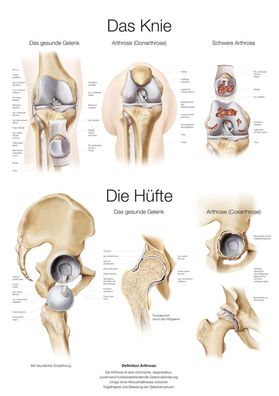 Lehrtafel Das Knie / Die Hüfte (deutsch) 70x100cm