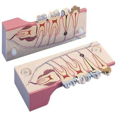 Morita 2-teiliges Molarmodell P13-TR9 - Stück