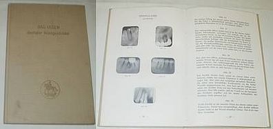 Das Lesen dentaler Röntgenbilder, 1936