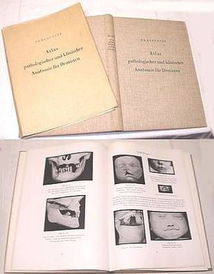 Atlas pathologischer und klinischer Anatomie für Dentisten 1938