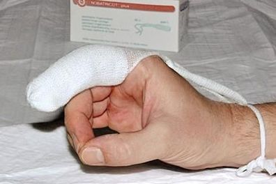Nobatricot plus Fingerverband 20 Stück mittel