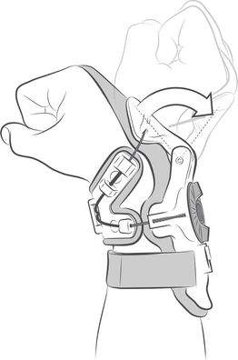 Mobius Protektor X8 Wrist Wire Kit 640-6040