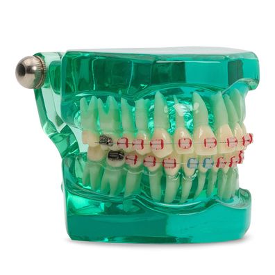 KFO Demonstrationsmodell mit Keramik Brackets