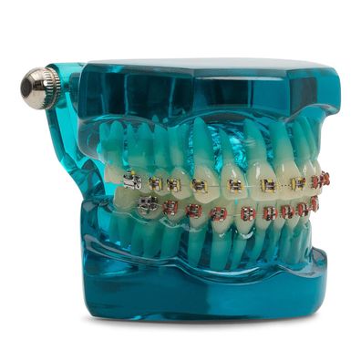 KFO Demonstrationsmodell mit Metall Brackets