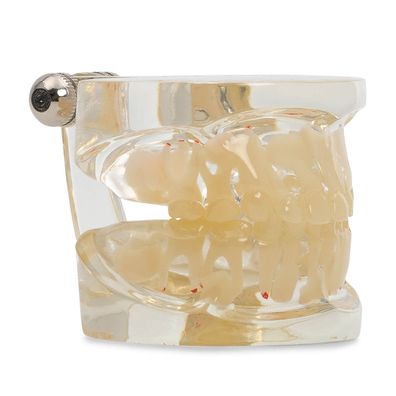 Kindergebiss Demonstrationsmodell