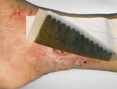 Vliwaktiv Ag 20 x 20 cm 10 Stück