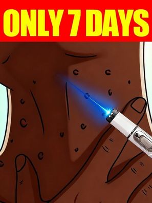 Generation-3 Laser Says Goodbye To all warts In 7 Day