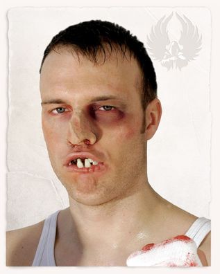 Boxer Zähne