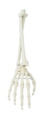 Hand mit Unterarm, Naturgetreuer Abguss, Pro- und Supination demonstrierbar