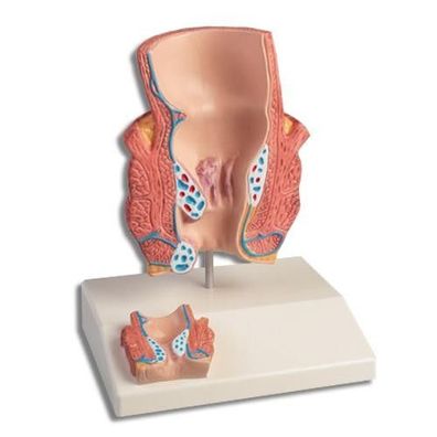 Hämorrhoidenmodell, Hämorrhoiden Modell Urologie