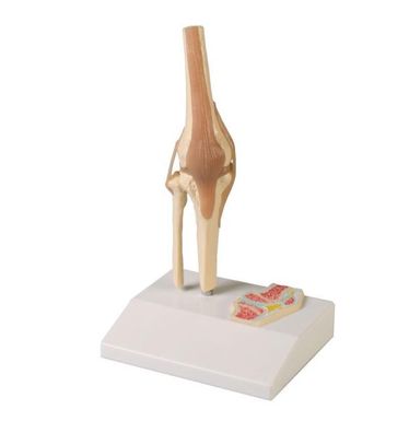 Mini Gelenkmodell Knie auf Sockel, etwa ½ natürlicher Größe, 12 x 10 x 20 cm