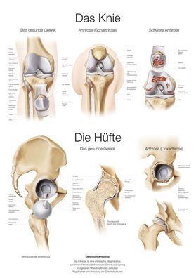 Lehrtafel Das Knie / Die Hüfte 50x70cm